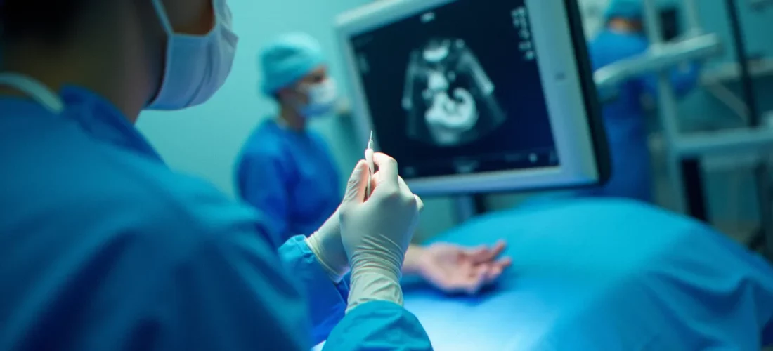 Un radiologue réalisant un medium biopsy test sous guidage échographique dans une salle d'imagerie interventionnelle